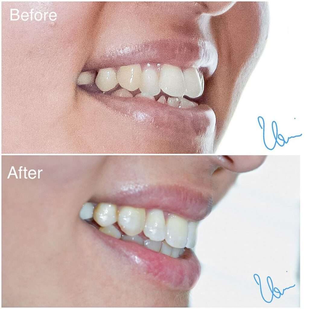 Orthodontist Dubai